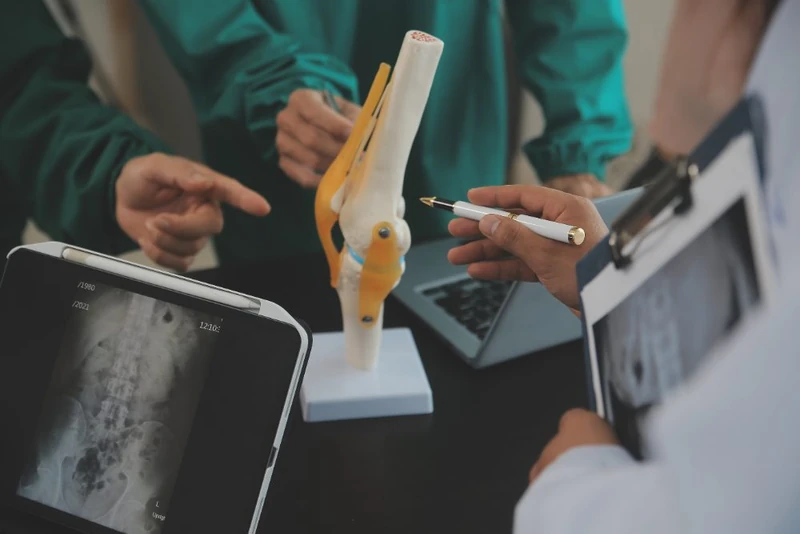 Doctors explaining arthroscopic knee procedures on a knee joint model next to an X-ray