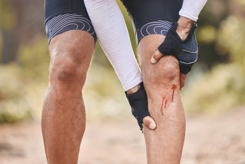 Runner holding an injured knee, a common way meniscus tears happen during sport